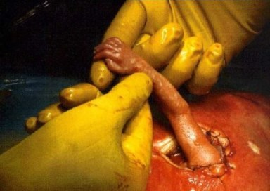 baby hand and doctor